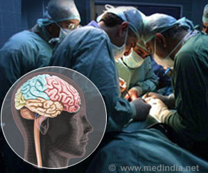 brain-surgery-treatment